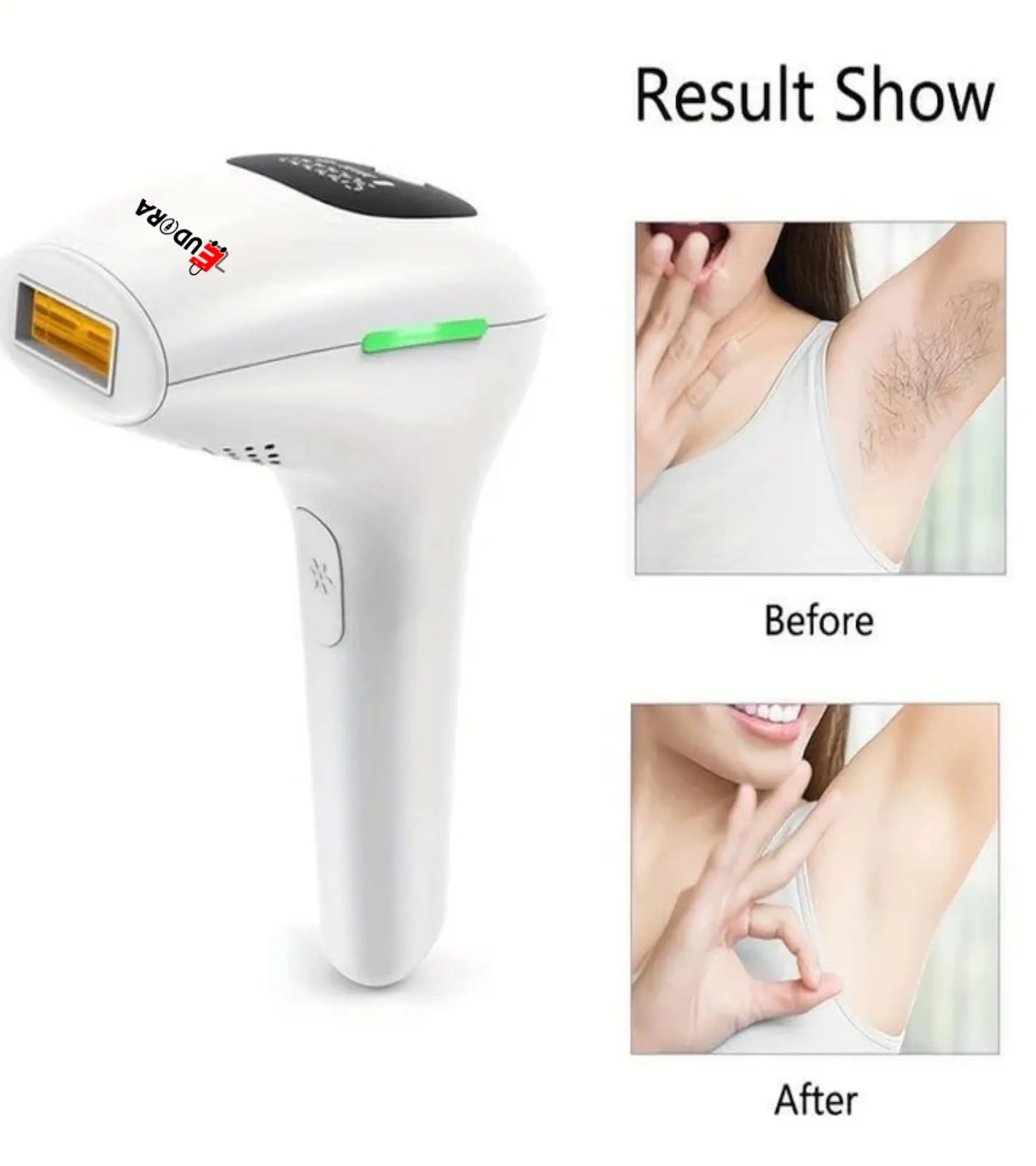 Premium IPL Laser Hair Removal Device – 1 Million Flashes - Image 4