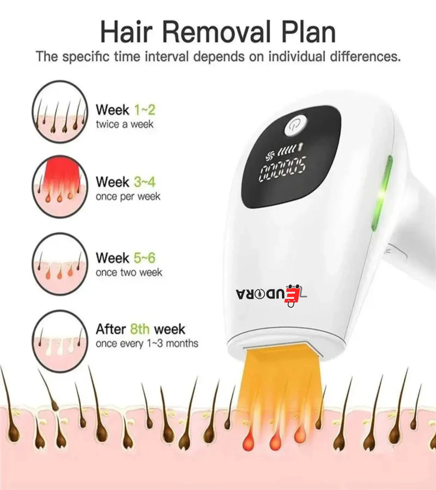Premium IPL Laser Hair Removal Device – 1 Million Flashes - Image 2